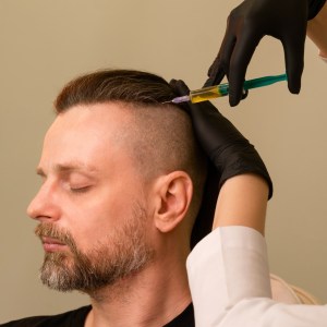Hair Restoration